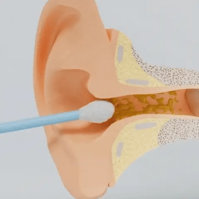 Omena - Nettoyage intelligent des oreilles grâce à une technologie de pointe