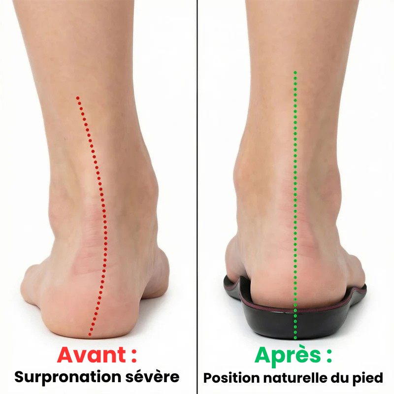Omena™ PowerStep