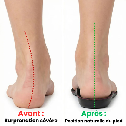 Omena™ PowerStep
